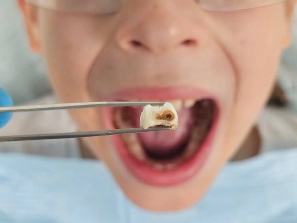 Best Urgent Dental Care for Toothache in Tuolumne City, CA