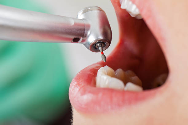 Best Pediatric Emergency Dentist in Tuolumne City, CA